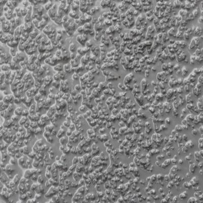 Aluminiumoxid Körnung medium 5kg 